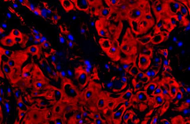 Stem Cells from Jaw Bone Help Repair Damaged Cartilage