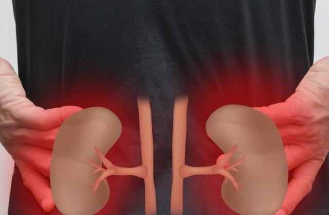 Kidney disease