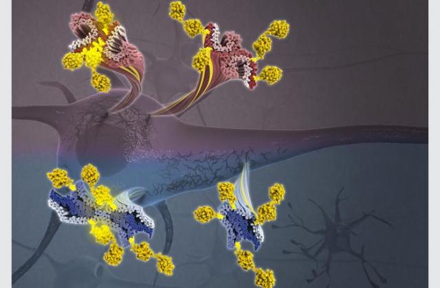 Tau protein and Alzheimer's disease